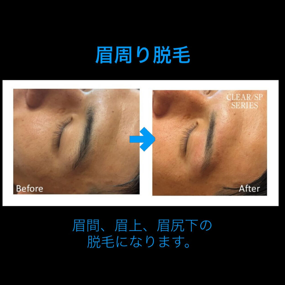 画像2896