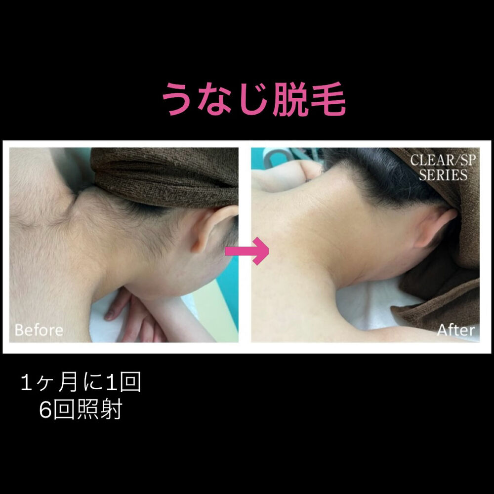 画像2916