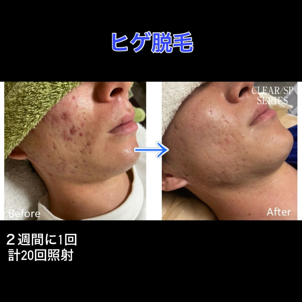 画像2920